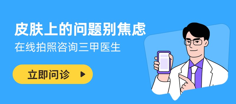  体癣防治：被低估的真菌感染与规范化应对指南 健康养生